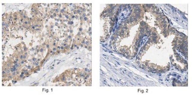 Anti-BTG3 Antibody from rabbit, purified by affinity chromatography