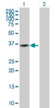 Anti-GMPR antibody produced in mouse purified immunoglobulin, buffered aqueous solution