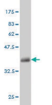 Monoclonal Anti-MUC5AC antibody produced in mouse clone 2H7, purified immunoglobulin, buffered aqueous solution