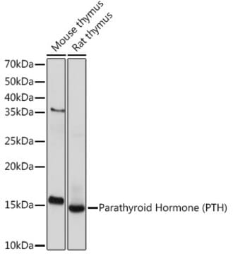 Anti-Parathyroid Hormone (PTH) Antibody, clone 5X6R6, Rabbit Monoclonal