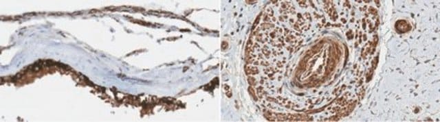 Anti-MTNR1B from rabbit, purified by affinity chromatography