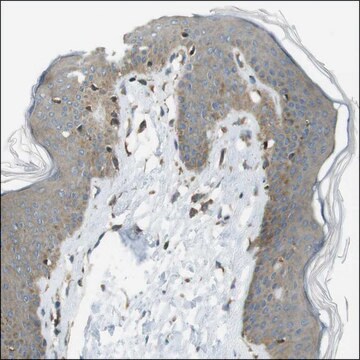 Anti-TRPM1 antibody produced in rabbit Prestige Antibodies&#174; Powered by Atlas Antibodies, affinity isolated antibody, buffered aqueous glycerol solution