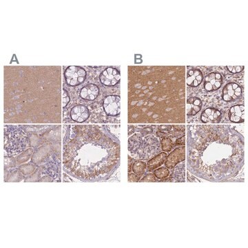 Anti-ADD1 antibody produced in rabbit Prestige Antibodies&#174; Powered by Atlas Antibodies, affinity isolated antibody, buffered aqueous glycerol solution