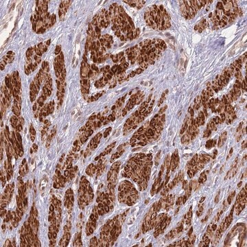 Anti-CCDC154 antibody produced in rabbit Prestige Antibodies&#174; Powered by Atlas Antibodies, affinity isolated antibody, buffered aqueous glycerol solution