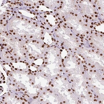 Anti-TMEM184C antibody produced in rabbit Prestige Antibodies&#174; Powered by Atlas Antibodies, affinity isolated antibody, buffered aqueous glycerol solution