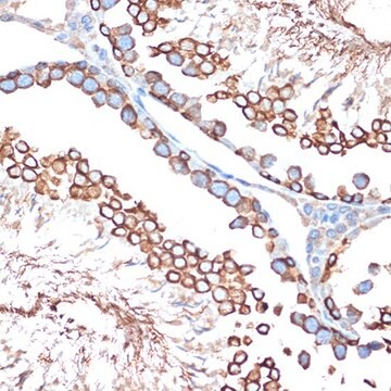 Anti-ACVR1B antibody produced in rabbit