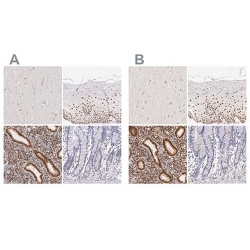 Anti-ESR1 antibody produced in rabbit Ab2, Prestige Antibodies&#174; Powered by Atlas Antibodies, affinity isolated antibody, buffered aqueous glycerol solution