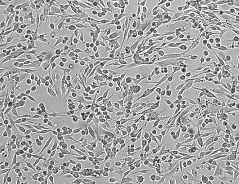 OSUMMER.4 Mouse NRAS-Mutant Melanoma Cell Line