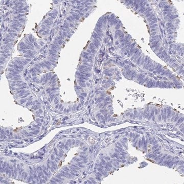 Anti-MORN2 antibody produced in rabbit Prestige Antibodies&#174; Powered by Atlas Antibodies, affinity isolated antibody, buffered aqueous glycerol solution