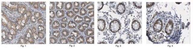 Anti-Apobec1 Antibody from rabbit, purified by affinity chromatography