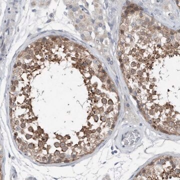 Anti-YRDC antibody produced in rabbit Prestige Antibodies&#174; Powered by Atlas Antibodies, affinity isolated antibody, buffered aqueous glycerol solution