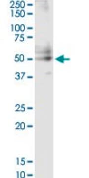 Monoclonal Anti-CSF2, (C-terminal) antibody produced in mouse clone 1D6, purified immunoglobulin, buffered aqueous solution