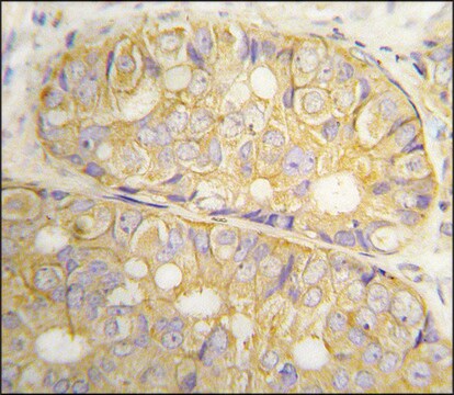 Anti-POTE (C-term L446) antibody produced in rabbit affinity isolated antibody, buffered aqueous solution