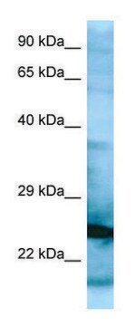 Anti-RPL15 (N-terminal) antibody produced in rabbit affinity isolated antibody