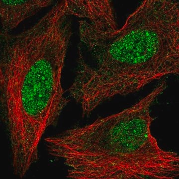 Anti-HOXD3 antibody produced in rabbit Prestige Antibodies&#174; Powered by Atlas Antibodies, affinity isolated antibody