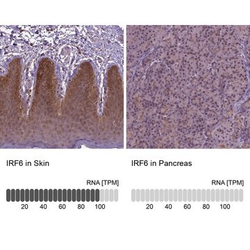 Anti-IRF6 antibody produced in rabbit Prestige Antibodies&#174; Powered by Atlas Antibodies, affinity isolated antibody, buffered aqueous glycerol solution