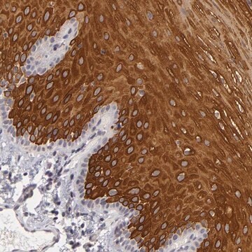 Anti-ALAS2 antibody produced in rabbit Prestige Antibodies&#174; Powered by Atlas Antibodies, affinity isolated antibody, buffered aqueous glycerol solution