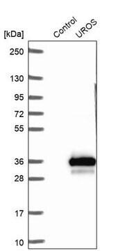 Anti-UROS antibody produced in rabbit Prestige Antibodies&#174; Powered by Atlas Antibodies, affinity isolated antibody, buffered aqueous glycerol solution