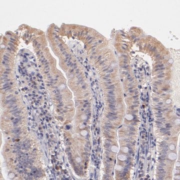 Anti-RNASEL antibody produced in rabbit Prestige Antibodies&#174; Powered by Atlas Antibodies, affinity isolated antibody, buffered aqueous glycerol solution