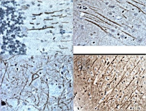 Anticuerpo anti-receptor de la sustancia P Chemicon&#174;, from guinea pig