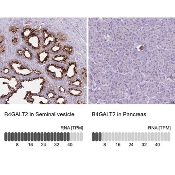 Anti-B4GALT2 antibody produced in rabbit Prestige Antibodies&#174; Powered by Atlas Antibodies, affinity isolated antibody, buffered aqueous glycerol solution