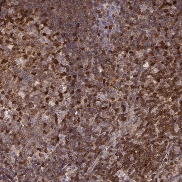 Anti-MFSD1 antibody produced in rabbit Prestige Antibodies&#174; Powered by Atlas Antibodies, affinity isolated antibody