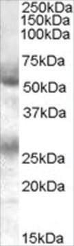 Anti-FLVCR antibody produced in goat affinity isolated antibody, buffered aqueous solution