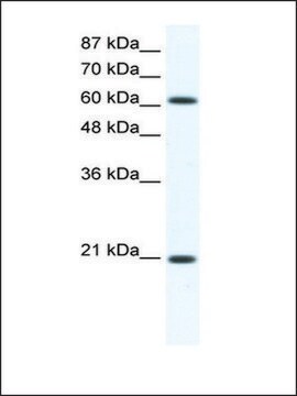 Anti-ANXA6 (AB1) antibody produced in rabbit IgG fraction of antiserum