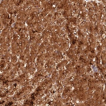 Anti-ACSM5 antibody produced in rabbit Prestige Antibodies&#174; Powered by Atlas Antibodies, affinity isolated antibody, buffered aqueous glycerol solution