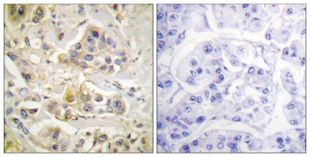 抗-AHR 兔抗 affinity isolated antibody