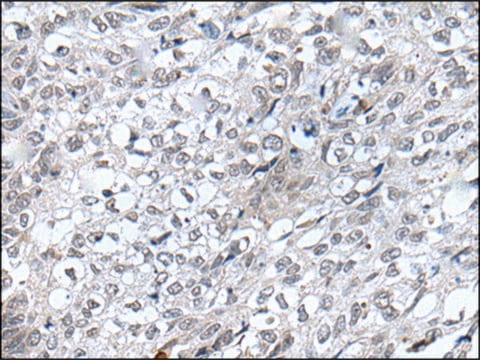 Anti-FLT4 affinity isolated antibody