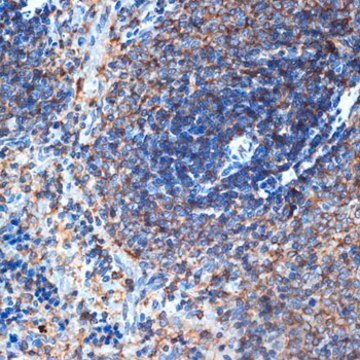 Anti-ELMO1 Antibody, clone 9X6Y6, Rabbit Monoclonal