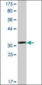 Monoclonal Anti-CRELD2 antibody produced in mouse clone 2B6, ascites fluid