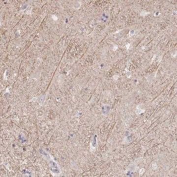 Anti-KCNJ12 antibody produced in rabbit Prestige Antibodies&#174; Powered by Atlas Antibodies, affinity isolated antibody, buffered aqueous glycerol solution