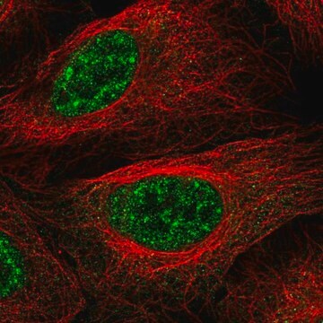 抗LHX4抗体 ウサギ宿主抗体 Prestige Antibodies&#174; Powered by Atlas Antibodies, affinity isolated antibody