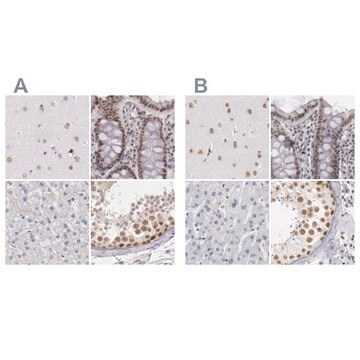 Anti-DGCR14 antibody produced in rabbit Ab2, Prestige Antibodies&#174; Powered by Atlas Antibodies, affinity isolated antibody, buffered aqueous glycerol solution