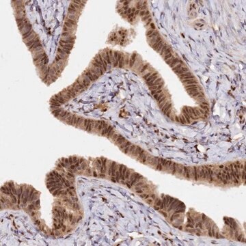 Anti-SECISBP2 antibody produced in rabbit Prestige Antibodies&#174; Powered by Atlas Antibodies, affinity isolated antibody, buffered aqueous glycerol solution