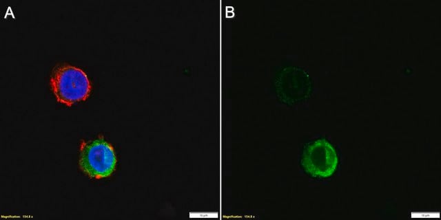 Anti-Migration Inhibitory Factor Related Proteins 8 and 14 Antibody, clone AHN-17 clone AHN-17, Chemicon&#174;, from mouse