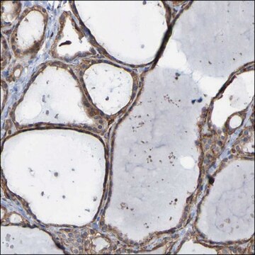 Anti-ELMOD3 antibody produced in rabbit Prestige Antibodies&#174; Powered by Atlas Antibodies, affinity isolated antibody, buffered aqueous glycerol solution