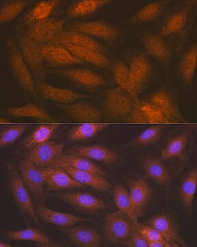 Anti-RAIDD/CRADD Antibody, clone 3Z9N8, Rabbit Monoclonal