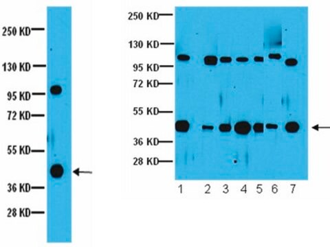 Anti-G&#946;5 Antibody Upstate&#174;, from rabbit