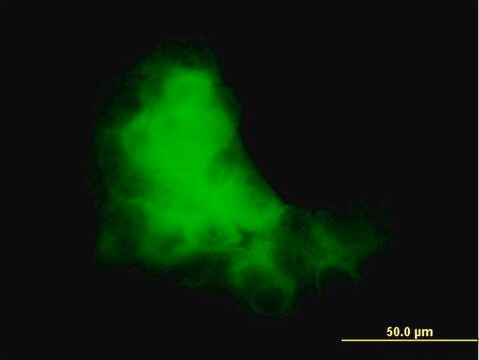 Monoclonal Anti-S100A7 antibody produced in mouse clone 1C1, purified immunoglobulin, buffered aqueous solution