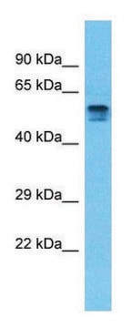 Anti-PDE4D (C-terminal) antibody produced in rabbit affinity isolated antibody