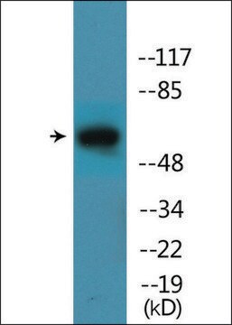 Anti-phospho-STK39 (pSer311) antibody produced in rabbit affinity isolated antibody