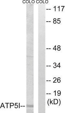 Anti-ATP5I antibody produced in rabbit affinity isolated antibody