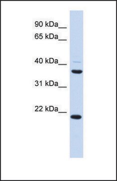 Anti-TMEM74 antibody produced in rabbit affinity isolated antibody