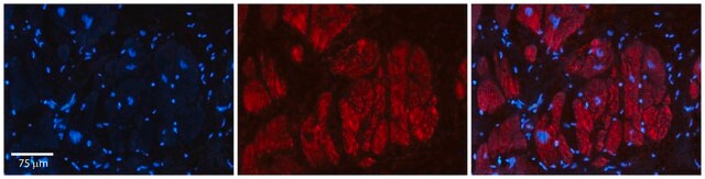 Anti-ZFR antibody produced in rabbit affinity isolated antibody