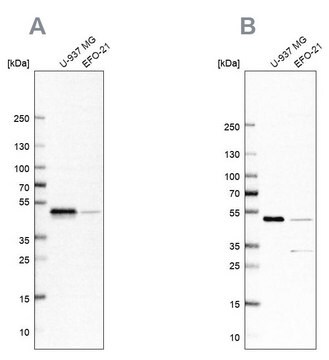 Anti-RCC1 antibody produced in rabbit Prestige Antibodies&#174; Powered by Atlas Antibodies, affinity isolated antibody, buffered aqueous glycerol solution, ab1