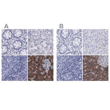 Anti-ARSG antibody produced in rabbit Prestige Antibodies&#174; Powered by Atlas Antibodies, affinity isolated antibody, buffered aqueous glycerol solution, Ab1