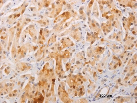 Monoclonal Anti-FAM84A antibody produced in mouse clone 1C2, purified immunoglobulin, buffered aqueous solution